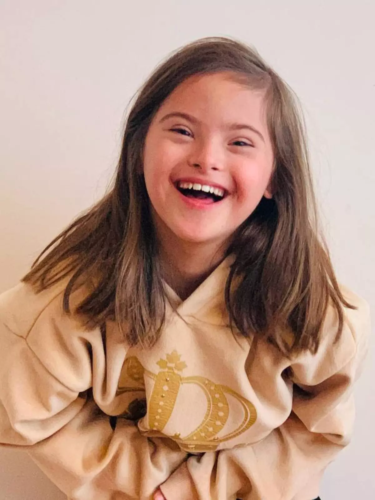 Síndromes e Transtornos do Desenvolvimento